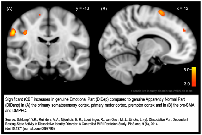 Two fMRI images with a color scale, captioned as showing higher regional blood flow in the somatosensory, motor and premotor cortex and the pre-SMA and dorsomedial prefrontal cortex